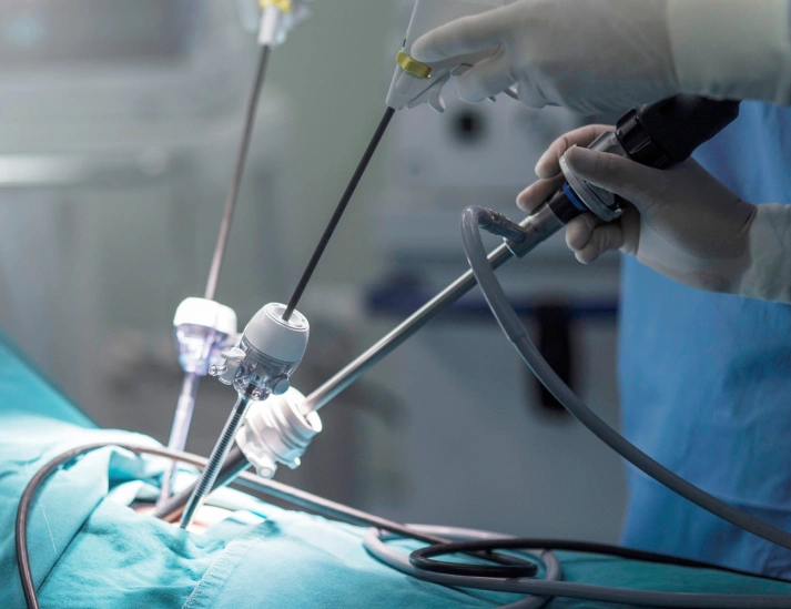 TKH Clinic minimally invasive laparoscopic surger