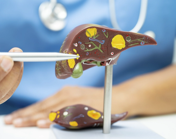 When Is Liver Surgery Recommended?